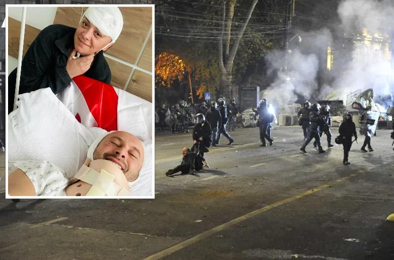 "კარგად ვიქნებით ორივე" - აქციაზე დაშავებული ჟურნალისტების ფოტო კლინიკიდან