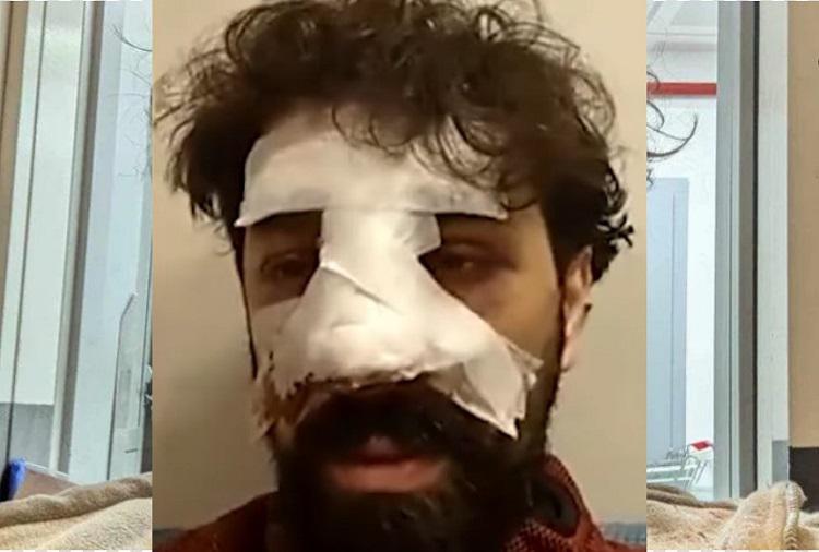 “მოულოდნელად დამარტყეს, როცა ვუთხარი რომ ჟურნალისტი ვარ - შემაგინეს და უფრო ძლიერად დამიწყეს ცემა...“ - რას ჰყვება ჟურნალისტი, რომელზეც აქციაზე ფიზიკურად იძალადეს