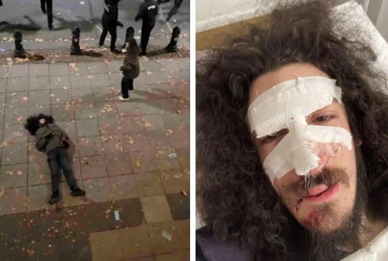 "ზვიომ შემოგვითვალა, რომ ერთი სული აქვს როდის დადგება ისევ ჩვენ გვერდით" - ვრცელდება სპეცრაზმის მიერ ნაცემი ზვიად მაისაშვილის ფოტო