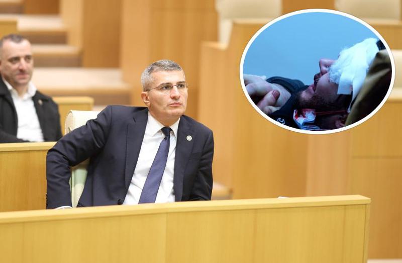 "როცა მიიყვანეს სასწრაფოსთან, თქვა, ფეიერვერკის ნაწილი მომხვდაო... ექიმები ეჭვობენ, რომ..." - რას ამბობს მდინარაძე აქციაზე დაშავებულ 22 წლის ბიჭზე