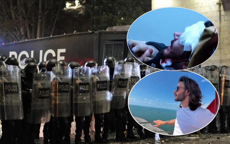 "მოსიყვარულე ალექსი ასე როგორ გაიმეტეს... დღეს ჩემს შვილს გაუხვრიტეს შუბლი, ხვალ სხვისას გაუხვრეტენ" - ემიგრაციაში მყოფი დედა შვილზე, რომელიც აქციაზე მძიმედ დაშავდა