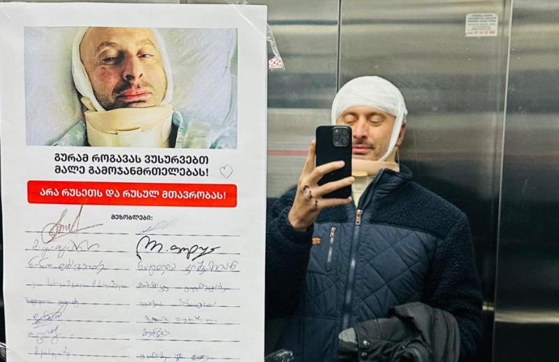 "სახლში დაბრუნებულს, ლიფტში ასეთი სურათი დამხვდა... მეკრძალება გადაადგილება, შესაძლებელია, სულ მცირე, კიდურებში მგრძნობელობის დაკარგვა" - რას წერს გურამ როგავა