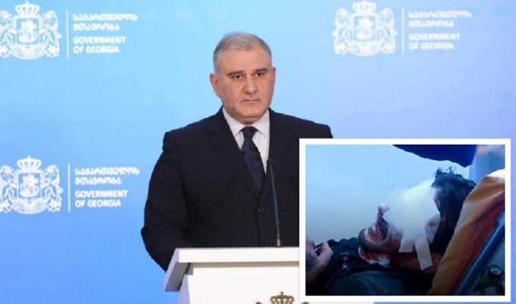 “თუ პაციენტის სამკურნალოდ, უცხოეთში გადაყვანის  საჭიროება იქნება, სახელმწიფო, სრულად აიღებს პასუხისმგებლობას“ - მიხეილ სარჯველაძე აქციაზე დაშავებულ 22 წლის ბიჭზე