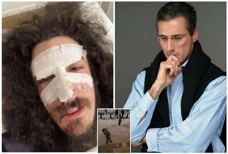 “ეს გმირი გია მაისაშვილის ძმისშვილია - ზვიად მაისაშვილი... ნაცებმა ბიძამისი გაიმეტეს, ქოცებმა ეს ბიჭი“ - რას წერს ირაკლი კაკაბაძე აქციაზე სასტიკად ნაცემ ახალგაზრდაზე