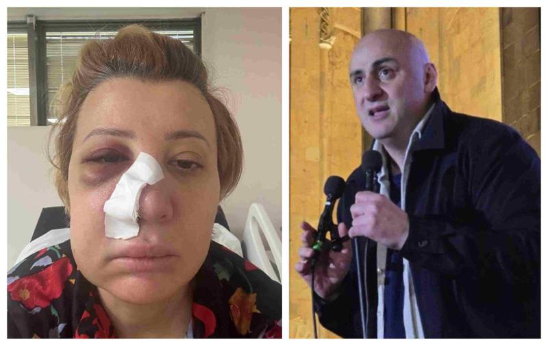 "ნინო გადაეფარა თანაგუნდელ ბიჭებს, რა დროსაც "ტიტუშკის" ნასროლი, ალესილი შუშის ბოთლი მოხვდა სახეში" - რა ინფორმაციას ავრცელებს ნიკა მელია