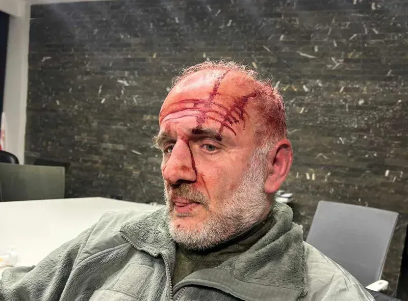 კობა ხაბაზის თქმით, 50-მდე ნიღბიანი პირი თავს დაესხა - ფოტოები პარტიის ოფისიდან, სადაც ცოტა ხნის წინ ხმაური იყო