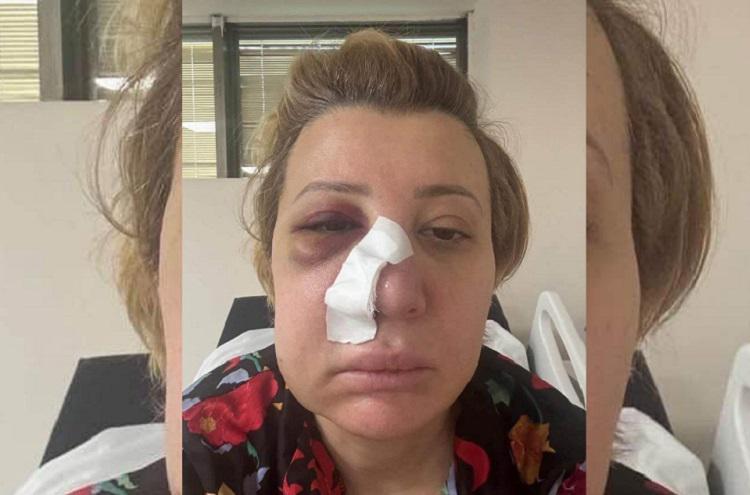 “დიაგნოზში წერია: ყვრიმალისა და ზედა ყბის ძვლების მოტეხილობა, მარჯვენა ყვრიმალ ზედა ყბის მოტეხილობა, ცხვირის ძვლის მოტეხილობა, ჭრილობა ცხვირის არეში“ - ნინო კვიტაიშვილი