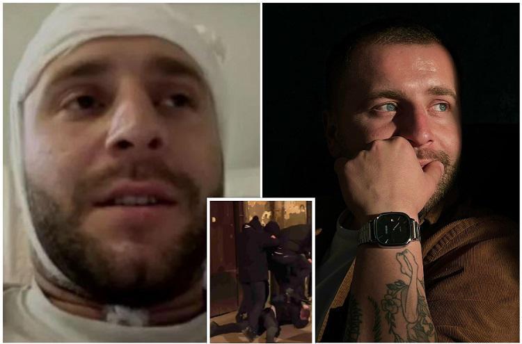 “ბრძოლა გრძელდება იქამდე, სანამ ქართველი ხალხის ნება არ აღსრულდება! საქართველო არ გარუსდება!“ - აქციაზე, სასტიკად ნაცემი ოპერატორი სახლში გაწერეს: როგორია მისი მდგომარეობა