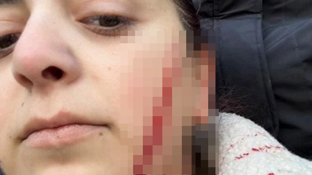 მედიის ინფორმაციით, დაბა კაზრეთში, უცნობი პირი სკოლის თანამშრომელს სამართებლით თავს დაესხა - რა დეტალები ხდება ცნობილი