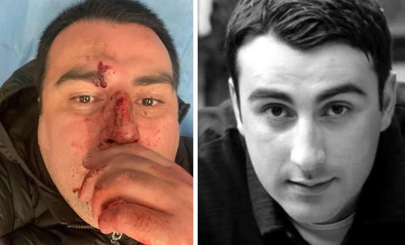 "შვილების თვალწინ დაესხნენ თავს! ეს არაა ხომ ძალადობა?!" - არსებული ინფორმაციით, ბესო ზანგურს სცემეს