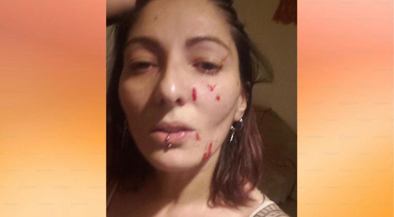 "სადარბაზოში დამხვდა 2 ტიპი და ხელჩართულ ბრძოლაში ცოტა სახე მიმიჩოხანეს" - მოქალაქე ია გაბუნიას ცნობით, მას  თავს დაესხნენ