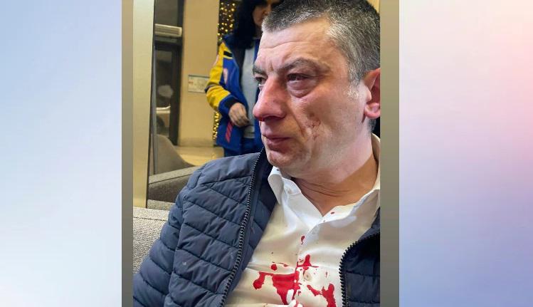 გიორგი გახარია თავდასხმის შემდეგ - რა ფოტო ვრცელდება სოციალურ ქსელში?