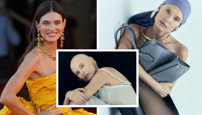 "თმა აღარ მაქვს, აღარ ვჯდები მოდელის სტანდარტებში" - იტალიელი მოდელი, ბიანკა ბალტი, რომელიც სიმსივნეს ებრძვის, ახალ ფოტოებს აქვეყნებს