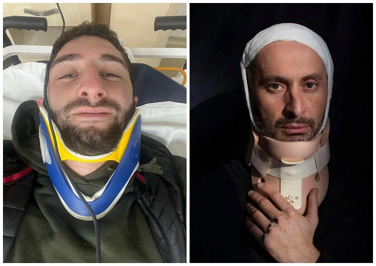 “მოვიკითხე და პასუხად ეს ფოტო რომ გამომიგზავნა, საშინელი ტკივილი ვიგრძენი... მალა გადარჩა“ - რას წერს გურამ როგავა აქციაზე დაშავებული ოპერატორის შესახებ