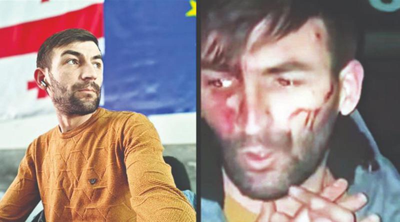 "უნდა მოგკლათო, კასტეტით მცემდნენ,  ჯიბიდან ტელეფონი ამომივარდა, აიღეს და თავში ჩამარტყეს" - რას ჰყვება აქტივისტი, რომელიც გორში ნიღბიანმა პირებმა გაიტაცეს