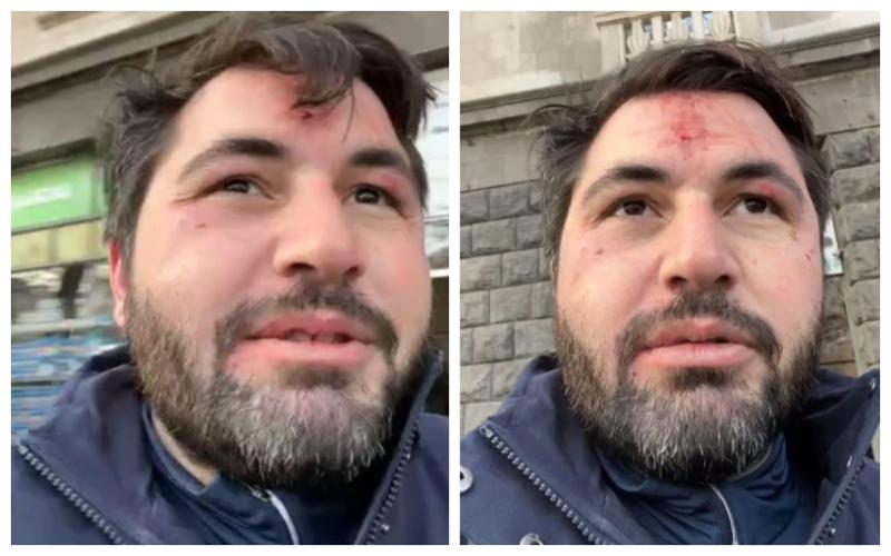 "თავს დამესხა სამი ნიღბიანი... ჩემთვის წყნარად ძაღლს ვასეირნებდი და მომვარდნენ" - რა ვიდეო მიმართვას ავრცელებს ლაშა გაბიტაშვილი