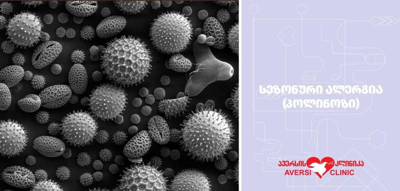 რა არის სეზონური ალერგია იგივე პოლინოზი და რომელი მცენარეთა მტვერი იწვევს ამ დაავადებას?