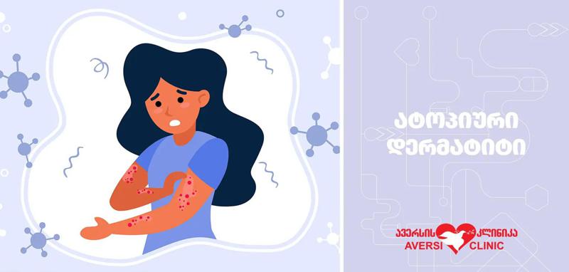 რა არის ატოპიური დერმატიტი?