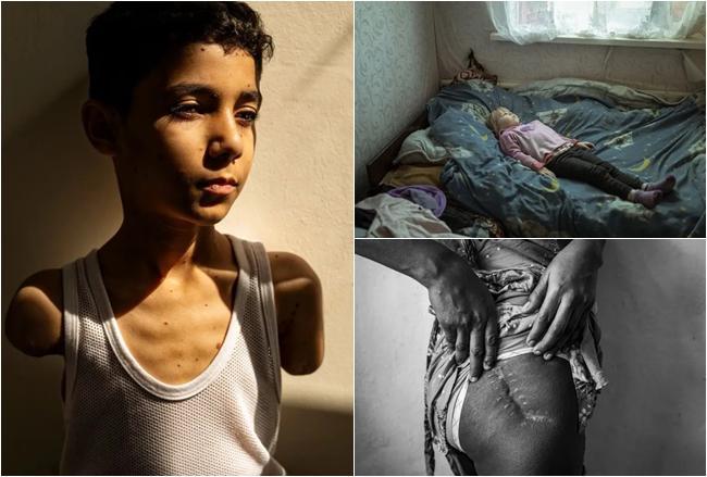 სულის შემძვრელი კადრები: პალესტინელი ბიჭი, უკრაინელი გოგო, "მიწა, რომელიც ქალებს არ ეკუთვნით" და სხვ. - World Press Photo-ს 2024 წლის საუკეთესო ფოტოები