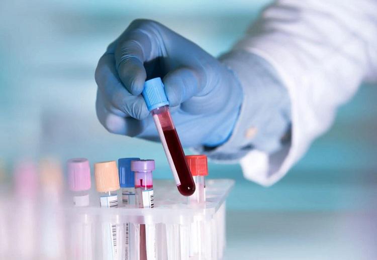 იაპონელი მეცნიერები აცხადებენ, რომ შექმნეს ხელოვნური სისხლი, რომელიც ყველა ჯგუფის სისხლს ერგება