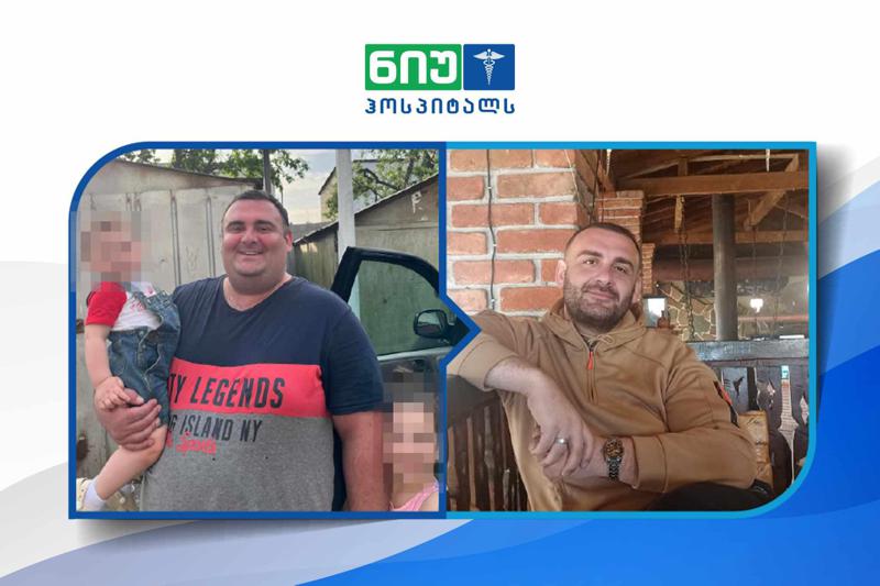 როგორ დაამარცხა 35 წლის ვლადიმერ აფციაურმა უკიდურესი მორბიდული სიმსუქნე?