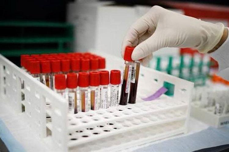 ფრანგმა მეცნიერებმა გვადალუპელ ქალში სისხლის ახალი ჯგუფი აღმოაჩინეს