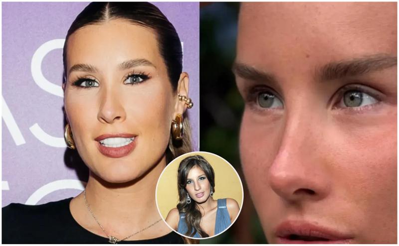 "თვალებიდან ნაპერწკლები გამცვივდა. ცხვირი შემიშუპდა და კეხი გაიზარდა" - ქეთა თოფურიამ კიდევ ერთხელ გაიკეთა ცხვირის ოპერაცია? რას ამბობს მომღერალი პლასტიკურ ჩარევებზე