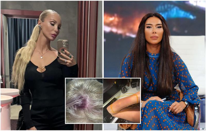 სკანდალი გრძელდება: ლიკა შენგელია სალომე გოგიაშვილს ეჭვიანობის ნიადაგზე ჩაქუჩით თავდასხმაში ადანაშაულებს, გოგიაშვილი კი სასამართლოში ჩივილს აპირებს (ვიდეო)