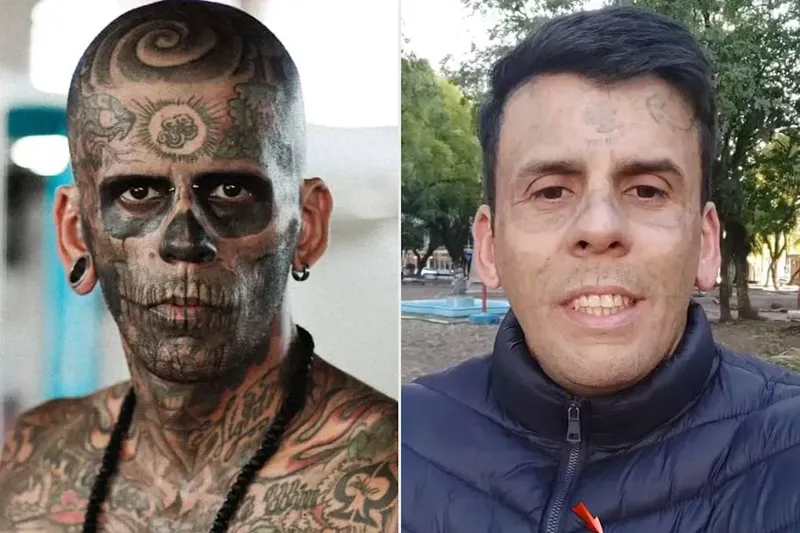 რა დაემართა კაცს, რომელსაც სხეულის 95% ტატუირებული ჰქონდა და მისი მოშორება გადაწყვიტა - "ეს იესო ქრისტეს წყალობით მოხდა“ (ფოტოები)
