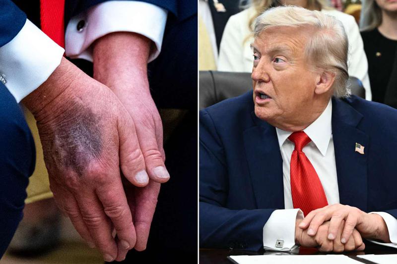 "როგორც ტრამპის პირადმა ექიმმა, შემიძლია გითხრათ, რომ ის ყველაზე ჯანმრთელი პრეზიდენტია, ვინც კი ამ ერს ოდესმე უნახავს“ - მითქმა-მოთქმა აშშ-ის პრეზიდენტის გარშემო და ბოლო განცხადებები