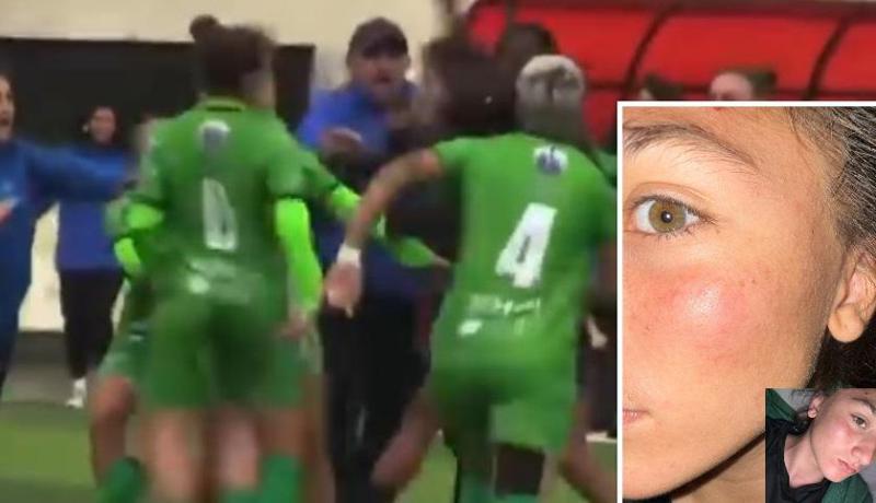 "ერთ-ერთმა გულშემატკივარმა სახეში მუშტი დამარტყა. ვის ევალებოდა ჩვენი დაცვა?" - ხელჩართული ბრძოლა ქალ ფეხბურთელებს შორის: რას წერს 16 წლის მოთამაშე?