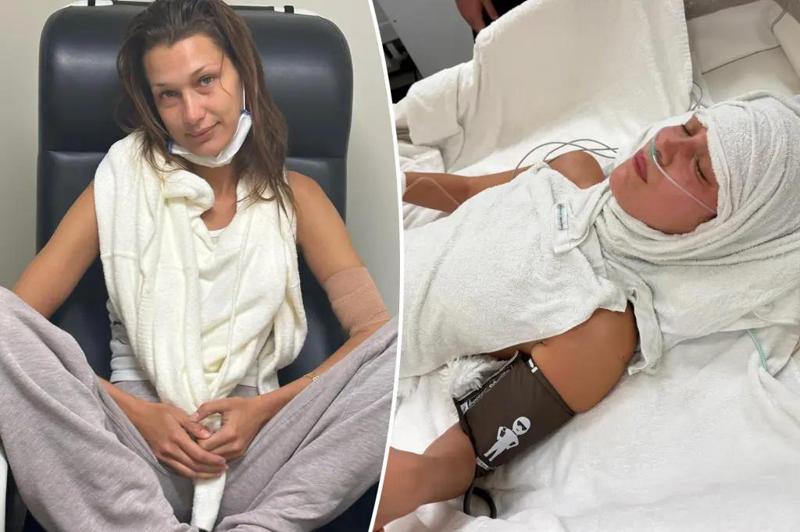 "ცხოვრების ორსახოვნება ქრონიკულ დაავადებასთან ერთად" - რას წერს ბელა ჰადიდი ქრონიკულ დაავადებასთან ბრძოლაზე