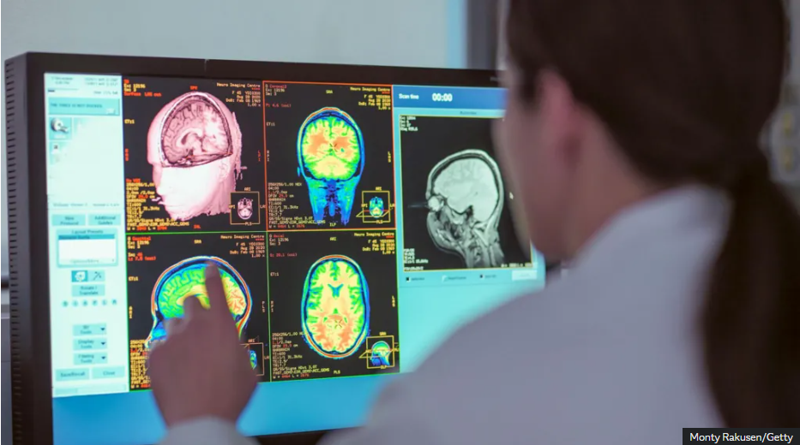 მოზარდობა 30 წლამდე გრძელდება, ზრდასრულობა კი 32 წლიდან იწყება - რა აჩვენა ახალმა კვლევამ: დადგინდა ტვინის განვითარების 4 ეტაპი