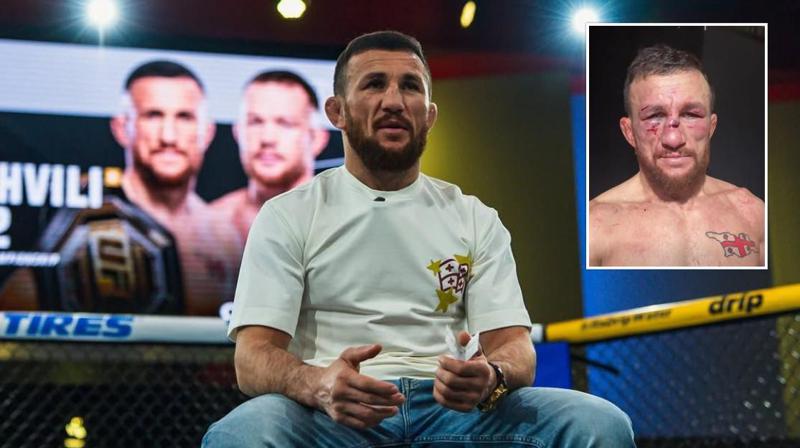 “თქვენი გულისთვის მზად ვარ სიკვდილისთვის! იმედია ჩემთან ერთად ხართ...“ - მერაბ დვალიშვილი ქართველ გულშემატკივრებს მიმართავს