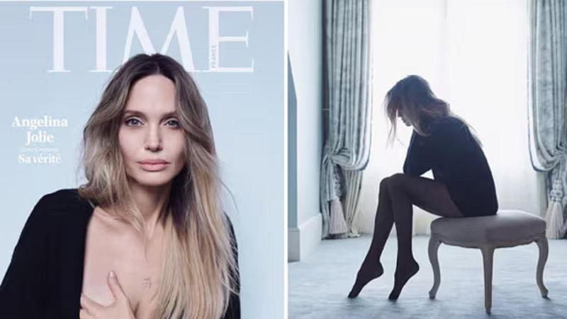 "ამ ნაიარევებს ვუზიარებ ქალებს" - Time აქვეყნებს ანჯელინა ჯოლის ფოტოებს, სადაც მასტექტომიის შედეგად დარჩენილი ნაწიბურები ჩანს