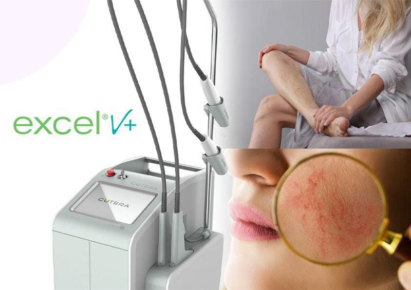 Cutera Excel V+ – ინოვაციური რევოლუცია ესთეტიკურ მედიცინაში უკვე საქართველოშია