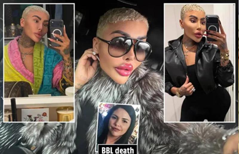 კიმ კარდაშიანით შეპყრობილი ტელევარსკვლავი გარდაიცვალა - დაკავებულია 2 ადამიანი: მას 50 ოპერაცია ჰქონდა გაკეთებული და სახის მოძრაობა უჭირდა