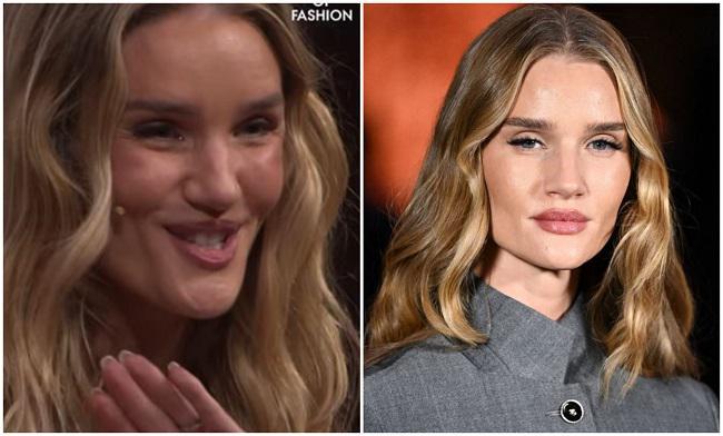 “რა გაუკეთა სახეს“ - წარუმატებელი პლასტიკური ქირურგია თუ არასახარბიელო კადრი?: როზი ჰანტინგტონ-უაითლი გულშემატკივრებმა ვეღარ იცნეს