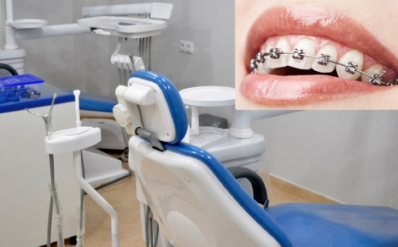 hotsale.ge-ზე სტომატოლოგიური კლინიკა Smile ფასდაკლებას გთავაზობთ